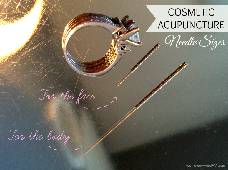 Cosmetic acupuncture needle sizes